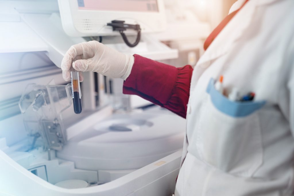 a health care worker runs a blood sample through a centerfuge 